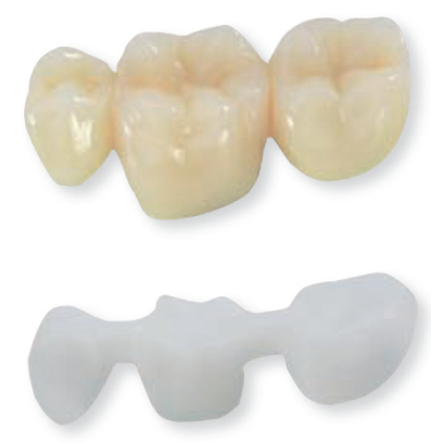 Protese Dentaria Zirconia